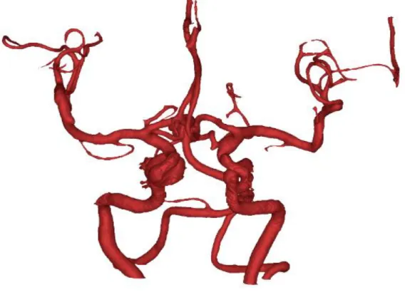 Figure 3- 1 The whole structures of all the blood vessels 