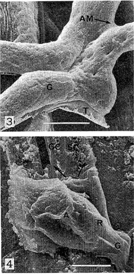 Fig.  1, 2.  Overlooking view  of  uredospores,  germ  tube,  and  young  appressorium  1  The  specimen  (fresh  cut  leaf) was subjected  to observation without  dehydration by  organic solvent  or  any  other  previous  treatment  (Method  A)  Germinate