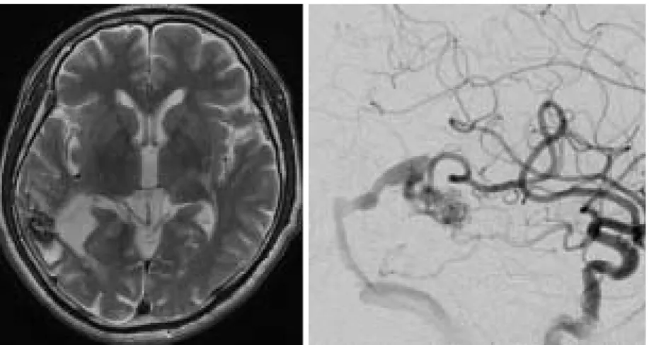 Fig. 2 Intraoperative view. 