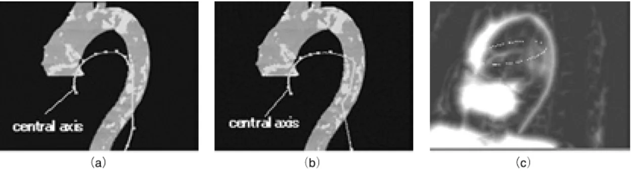Fig. 2 An example of the failure in the rough matching : （a） result of rough matching, （b） result of precious matching and