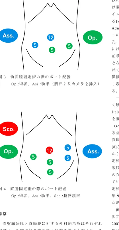 図 3  仙 骨 腟 固 定 術 の 際 の ポ ー ト 配 置  