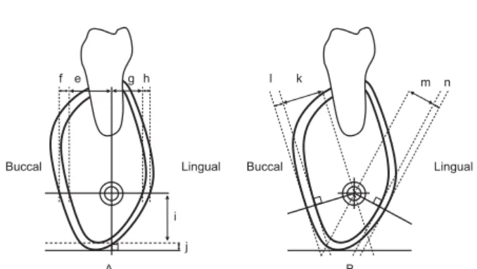 Fig 5 Vertical distance and cortical bone thickness of mandibular foramen.