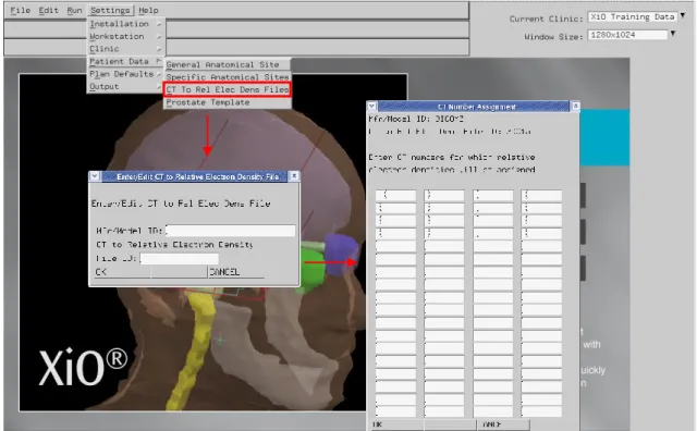 図 1.2 CT to Rel Elec Dens Files 