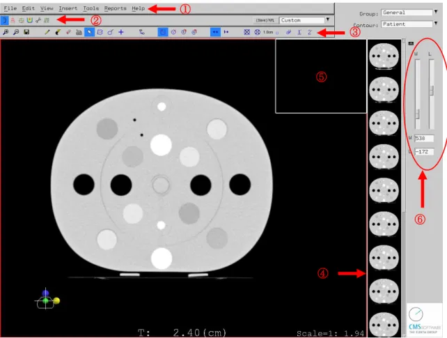 図 3.3  PFM の画面  ①  プルダウンメニュー  ②  メインツールバー  ③  サブツールバー  ④  サムネイル  ⑤  3D ビュー  ⑥  W/L 設定  メインツールバーのショートカットキーは Shift を押しながら左から右への順番で F1, F2, F3, F4,  F5, F6 を押すとそれぞれのアイコンをマウスでクリックしているのと同じになります。  サブツールバーの場合は左から右へ F1  ～F12 の順でそれぞれのアイコンはファンクションキー と関連づけられています。保存ボタ