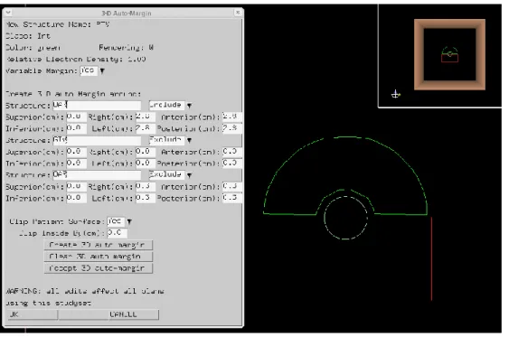 図 3.9  IMRT Benchmark (3-D Auto-Margin) 
