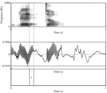 Figure 5 compares the acoustic and EGG signals of /reddo/. Voicing, as indicated in the acoustic spectrogram (top panel) by the “voice bar” in the lower frequencies, as well as the continuation of formants in the upper frequencies, is longer than the glott