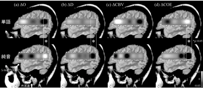 図 1　単語と純音の聴取中（1500ms）におけるΔO、ΔD、ΔCBV、ΔCOE 増減の 2 次元イメージの比較 　上段が単語聴取中、下段が純音聴取中の 4 つの変化量の全被験者平均の増減イメージである。MRI 画像上に 計測領域の反応を重ねて提示した。外耳道とシルビウス裂の位置を図中矢印で示した。白色が濃くなるにつれ増 加が強いことを示し、黒色が濃くなるにつれ減少が強いことを示す。計測チャンネルは、片半球 8ch とし、左半 球は前から 1 ～ 8ch、右半球は前から 9 ～ 16ch とした。課題間比較