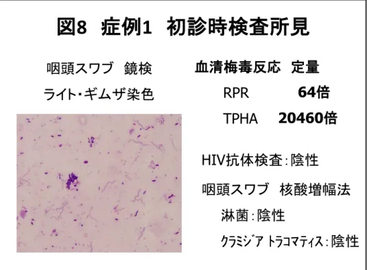 図 8 症例 1 初診時検査所見 咽頭スワブ 鏡検 ライト・ギムザ染色 咽頭スワブ 核酸増幅法 淋菌：陰性 ｸﾗﾐｼﾞｱ ﾄﾗｺﾏﾃｨｽ：陰性血清梅毒反応 定量RPRTPHAHIV抗体検査：陰性64倍20460倍 図 9 症例 2 初診時咽頭所見