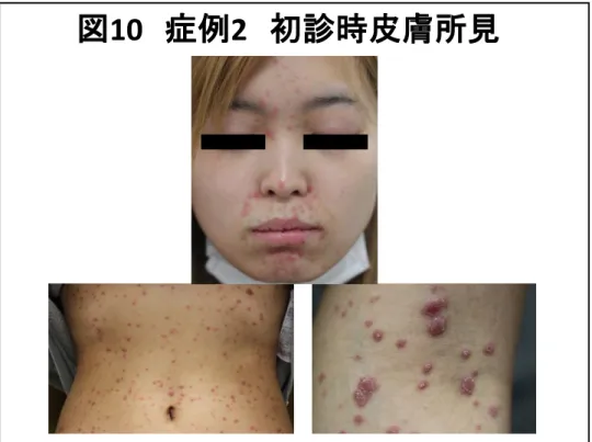 図 10 症例 2 初診時皮膚所見