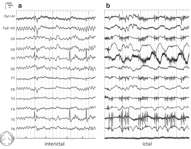 Fig. 1 EEG on admission.