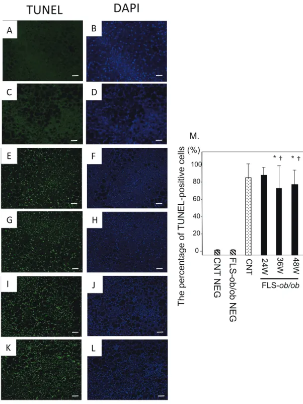 Fig. 4.  TUNEL staining. Representative images of TUNEL staining in liver specimens from control and NASH model mice with  quantifi cation of TUNEL-positive cells
