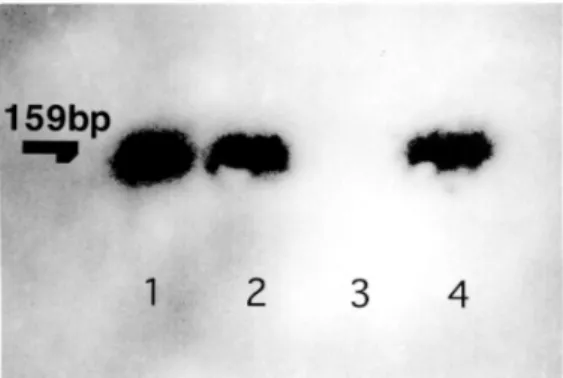Fig. 5.  PCR-Southern analysis of HTLV-I provirus in peripheral blood lymphocytes of the patient in case 2
