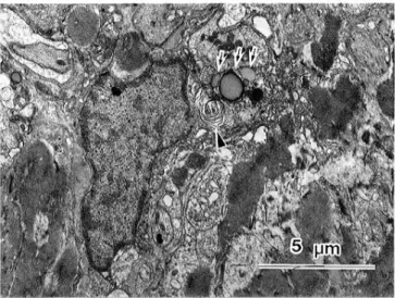 Fig. 9.  Lipid-like substances (arrows) and a myelin-like structure (arrowhead) are seen in the relatively well preserved cytoplasm of the lens epithelial cell.