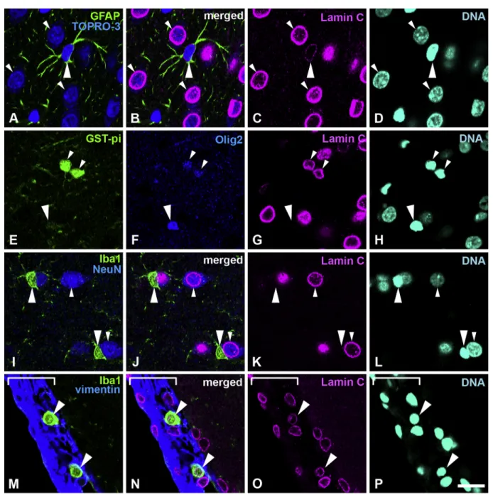 Fig. 1. Distribution of lamin A in the cerebral cortex. A–H, Sections were stained with antibodies against lamin A (magenta), GFAP (green) and nestin (blue)