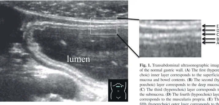Fig. 1.  Transabdominal ultrasonographic image  of the normal gastric wall. ( A ) The fi rst  (hypere-choic) inner layer corresponds to the superficial  mucosa and bowel contents