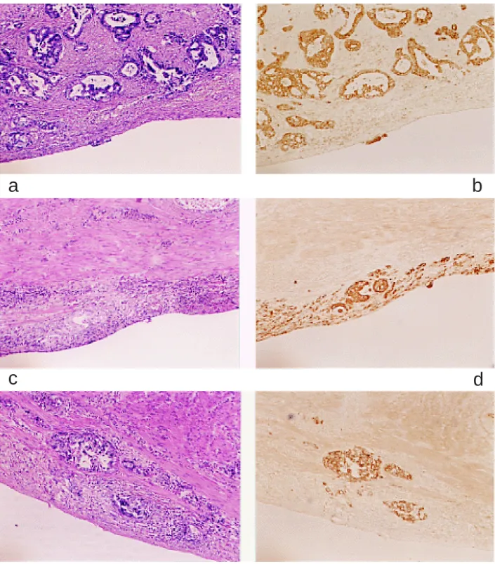 Fig. 1.  Comparison of the results between H&amp;E and CK stainings.