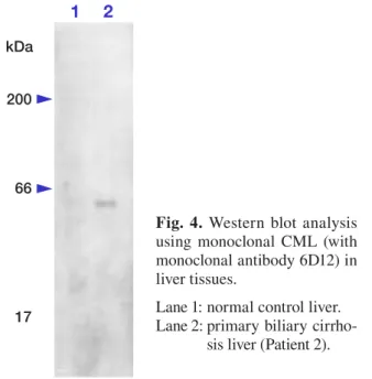 Fig.  4.  Western  blot  analysis  using  monoclonal  CML  (with  monoclonal antibody 6D12) in  liver tissues