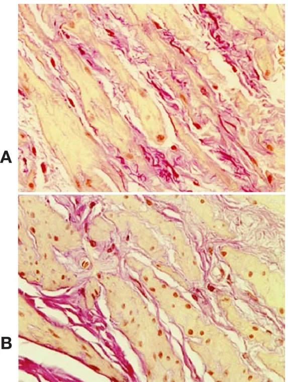 Fig. 1.  Light micrographic presentations of sections of the bladder body in elderly male rats (Elastica-van Gieson  stain;  original  magniﬁ cation,  ×  400)