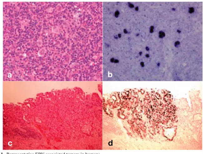 Fig. 1.  Representative EBV-associated tumors in humans.  
