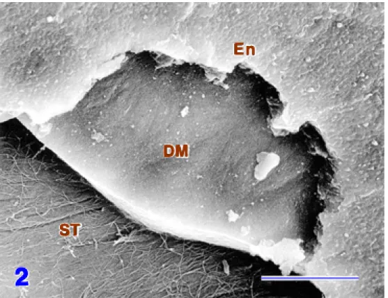 Fig. 2.  SEM image of the mechanically-fractured cornea showing surfaces of the endothelium (En), Descemet’s membrane (DM) and stroma (ST)