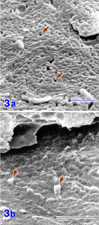 Fig. 3.  SEM images of the basal surface of the endothelium (a) and the endothelial surface of Descemet’s membrane (b) from the specimens prepared by the mechanical separation method.