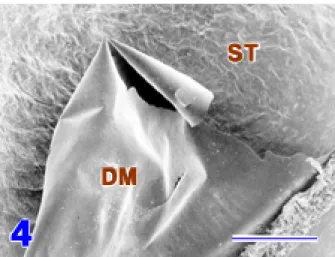 Fig. 4.    Low-magnified SEM image of Descemet’s membrane (DM) exfoliated from the stroma (ST) by the surface tension
