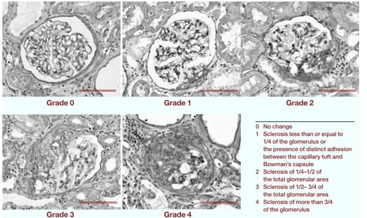 Fig. 2.  Course of mean systolic blood pressure in the 5 groups.  The systolic blood pressure of rats is significantly de- de-creased at 12 weeks of administration in groups of low OLM ( ), high OLM ( ) and OLM+TEM ( ) when compared  with in the 5/6-Nx gro