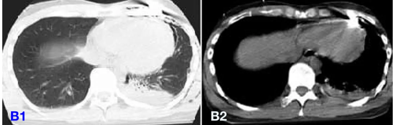 Fig. 3.  The knife has not reached the heart or lungs. 