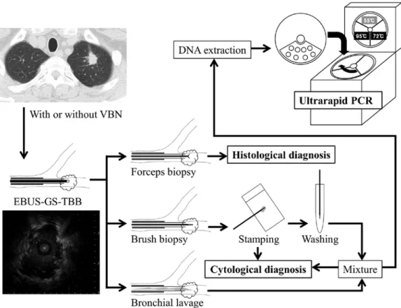 Figure 2. Examination flow chart. An EBUS probe with GS was led into the target lesion and adjusted with EBUS imaging