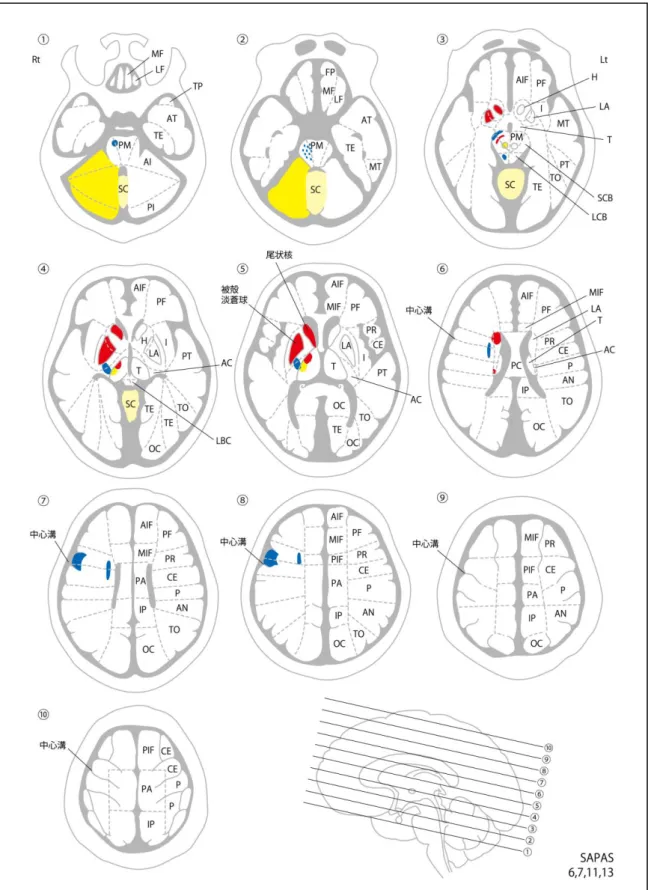 Fig. 4-2 One example of relationship between cerebral injury and functional disorder 