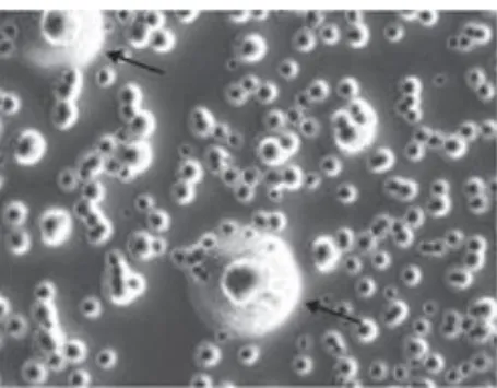 Figure 1-1. Typical Mycoplasma colony, having the classic fried-egg morphology 6 .  ヒトから分離されたマイコプラズマのうち数種類の菌体の病原性が明らかと