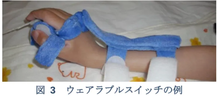 図  3  ウェアラブルスイッチの例 