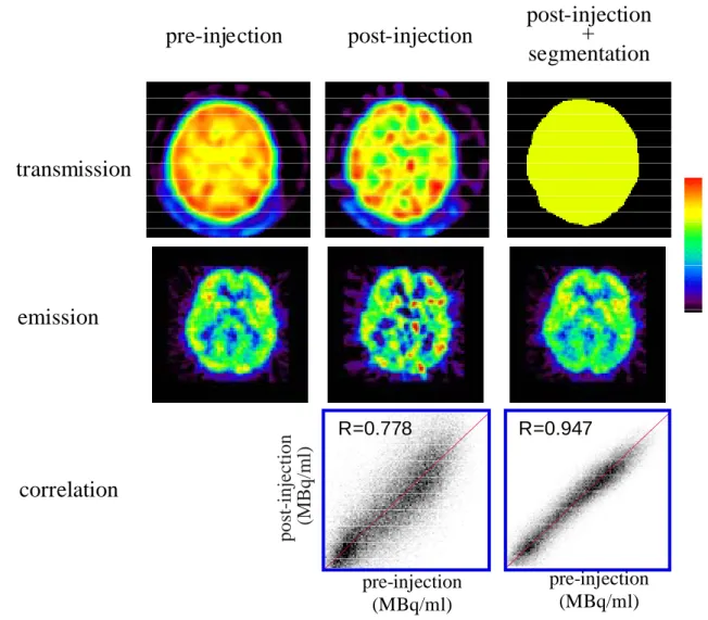 Fig.
2.3.7　Pre-injection 法、PITS 法、SPITS 法による 18 F-FDG 脳画像の比較。PITS