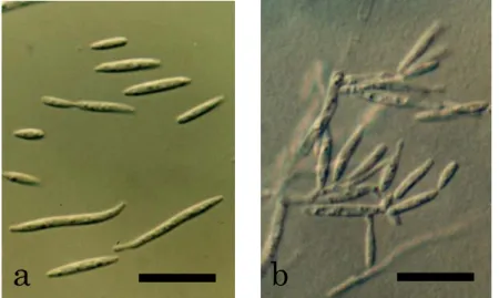 Fig. 7.  Cultures of  Meira  sp. isolates PFS 002, PFS  023 and PFS 034 (left to right) on PDA (upper) and  YMA (lower) after 14 days at 25℃