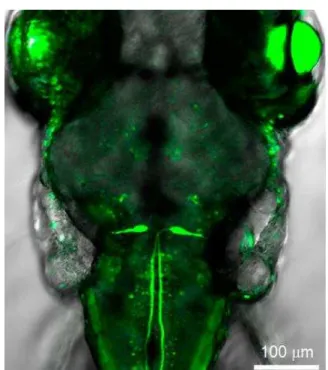 図 1   M 細胞 中央 左 一対あ 神経細胞 GFP 発現 ン