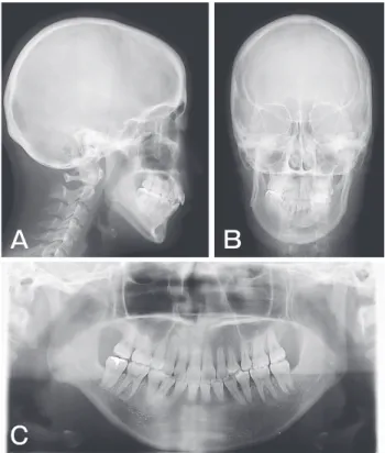 Fig. 6　 Posttreatment cephalograms and a panoramic radiograph.  