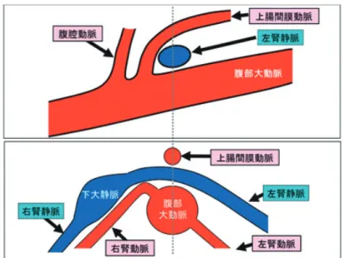Fig. 6  断層法の表示（上段：長軸，下段：短軸） Table 3  左右の腎動脈の本数とその比率（血管造影） 1 本 2 本 3 本 4 本 右 83 ％ 15 ％ 1 ％ 0 ％ 左 86 ％ 12 ％ 1 ％ 0 