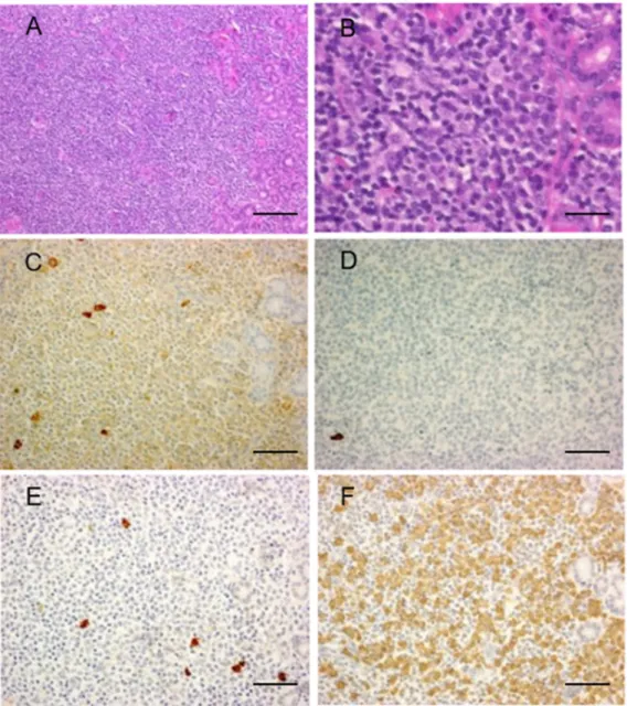 Figure 3. Marginal zone lymphoma without IgG4-positive cells. Representative pathological im- im-ages of marginal zone lymphoma without IgG4-positive cells