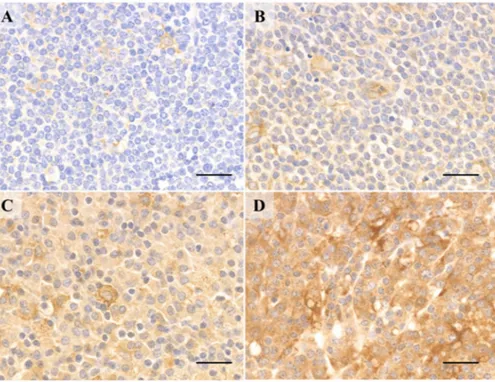 Figure 4. Activation-induced cytidine deaminase intensity index with immunohistochemical stain- stain-ing