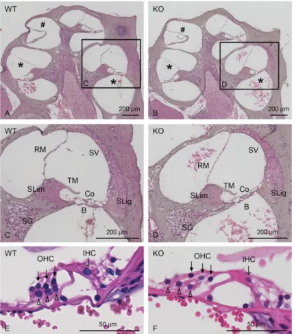 Fig 6. Representative images of HE-stained midmodiolar cochlear sections. Histological comparison between WT (A, C, E) and Col4a6 KO (B, D, F) mice