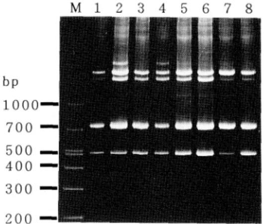 Fig.  1  Comparison  of  amplified  products  by  AP- AP-PCR  according  to  the  methods  of  DNA   extrac-tion  (MRSA  with  coagulase  type  IV,  M13  reverse primer  was  used).