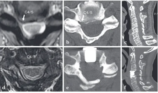 Fig.  3 Radiological images of Case 6