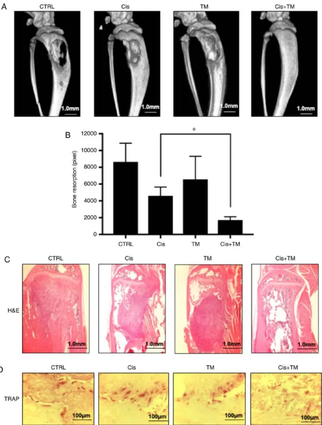 Figure 4. Effects of tetrathiomolybdate (TM) on the mouse model of cancer-associated bone destruction