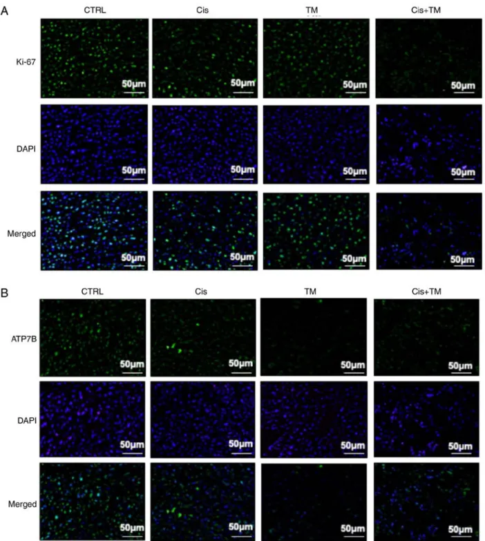 Figure 6. Immunofluorescence analysis of the tumor in the bone marrow in the mouse model of bone invasion