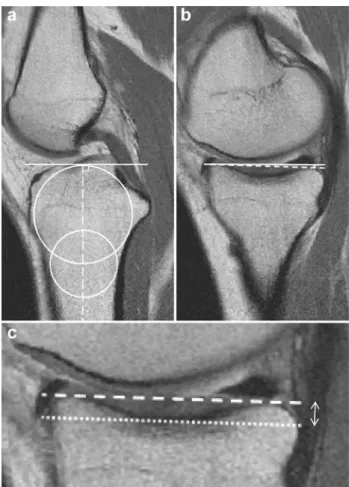 Fig. 1    Magnetic resonance images of a normal left knee. a Determi- Determi-nation of the tibial axis (long-dashed line) according to the method  described by Hudek et  al