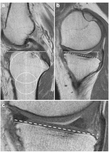 Fig. 3    Magnetic resonance image-based medial tibial slope. The  medial tibial slope in the medial meniscus posterior root tear  (MMPRT) group was significantly steeper than that in the volunteer  group and the anterior cruciate ligament (ACL) group