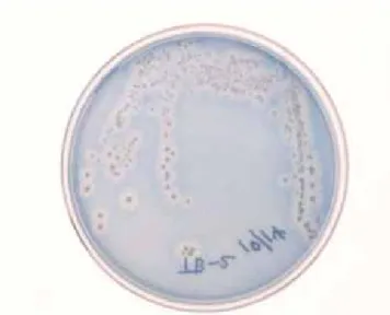 図 5  Cellulose Azure 添加寒天培地によるセルラーゼ生産菌の検出  微生物コロニー周囲の色素結合セルロースが分解されることにより  ハローが生じる。 
