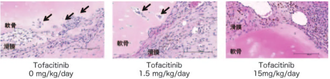 図 4 Tofacitinib による滑膜細胞の軟骨破壊抑制作用 関節置換術施行関節リウマチ患者より滑膜と軟骨を採取し，免疫不全マウスの背部皮下に移植し，Tofacitinib を表記の濃度で 4 週間投与後，移植組織を摘出し，病理学的評価を行った． 矢印は滑膜が軟骨内に浸潤している部位を示す． カインである IL-6 の産生と細胞内シグナル伝達を 抑制していると考えられる．IL-6 は細胞表面上の 受容体に結合後，JAK3 ではなく JAK1/JAK2 を介 したシグナル伝達を活性化するため，oŠ-tar