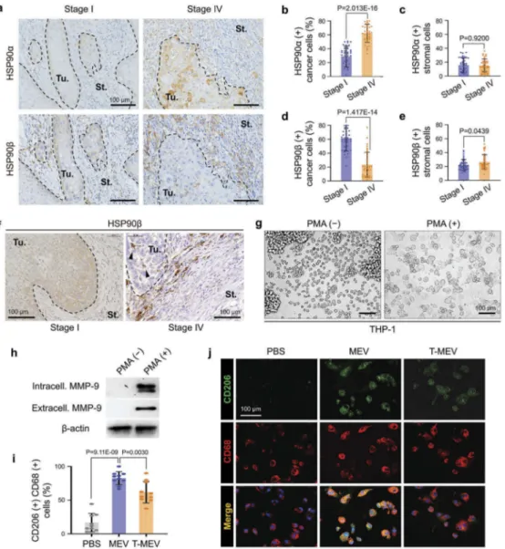 Figure 7. Metastatic oral cancer-derived MEVs induced macrophages M2 polarization. (a – f) Immunohistochemistry (IHC) of oral cancer patient-derived specimens