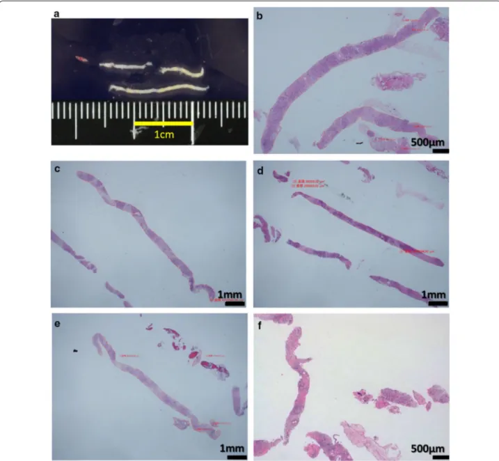 Fig. 3  Pancreatic tissue obtained by the 21-gauge Menghini-type needle with the rolling method